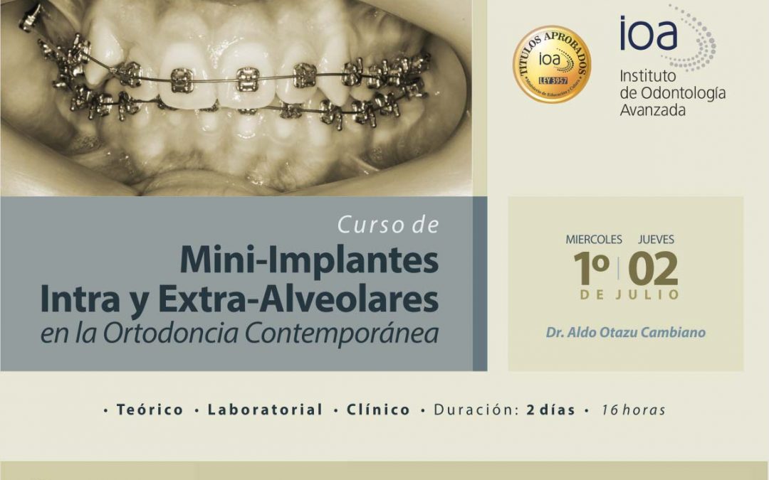 Mini Implantes Intra y Extra Alveolares