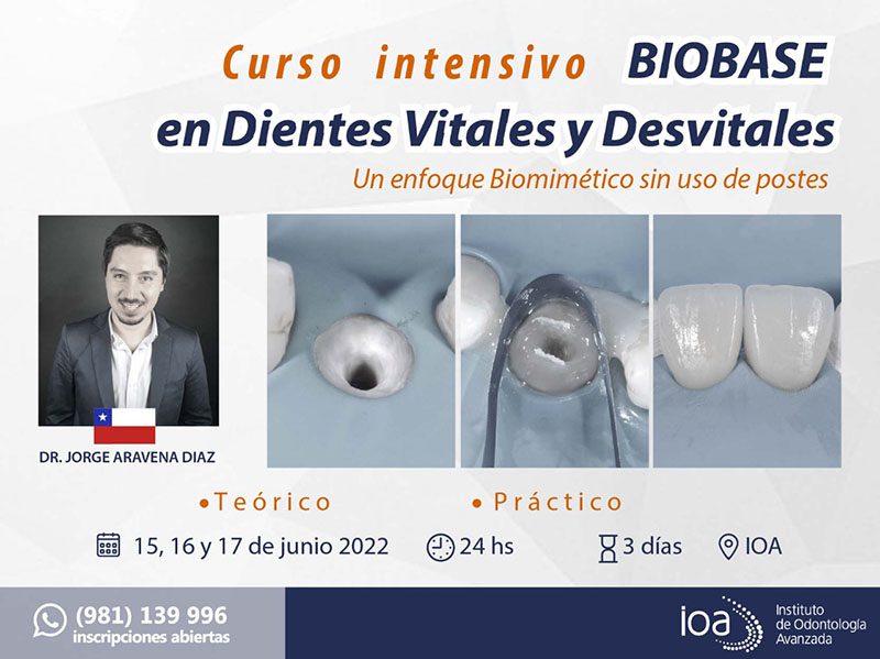 Curso intensivo BIOBASE en Dientes Vitales y Desvitaes