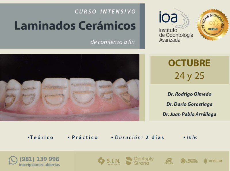Curso Intensivo de Laminados Cerámicos