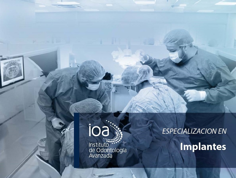 Curso de Especialización en Implantes 2024
