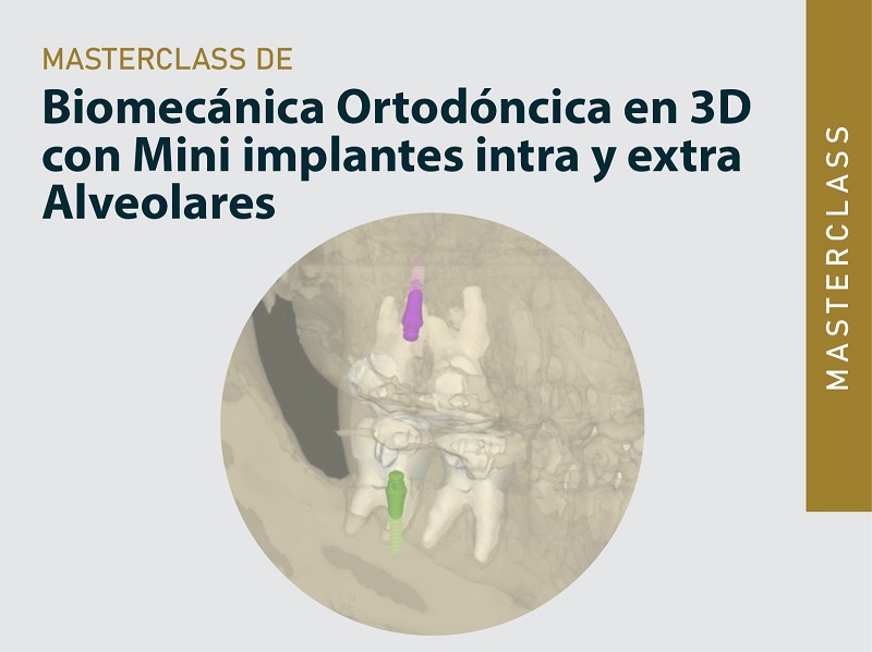 MASTERCLASS Biomecánica Ortodóncica en 3D