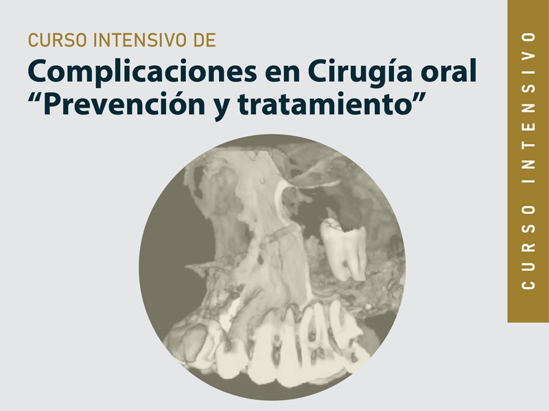 Curso Intensivo de Complicaciones en Cirugía oral Prevención y tratamiento
