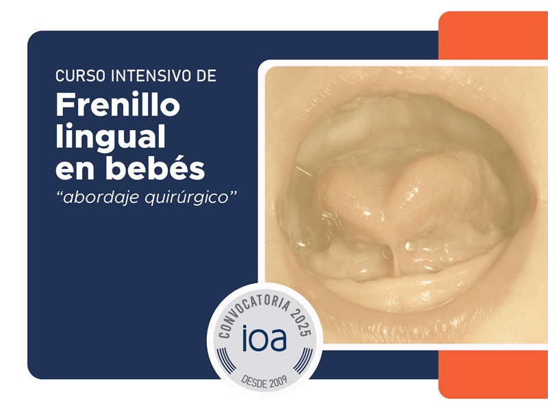 Curso Intensivo de Frenillo lingual en bebés «Abordaje quirúrgico»