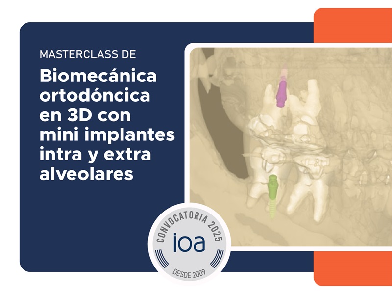 Curso Intensivo de Biomecánica Ortodóncica en 3D con Mini Implantes – 2025