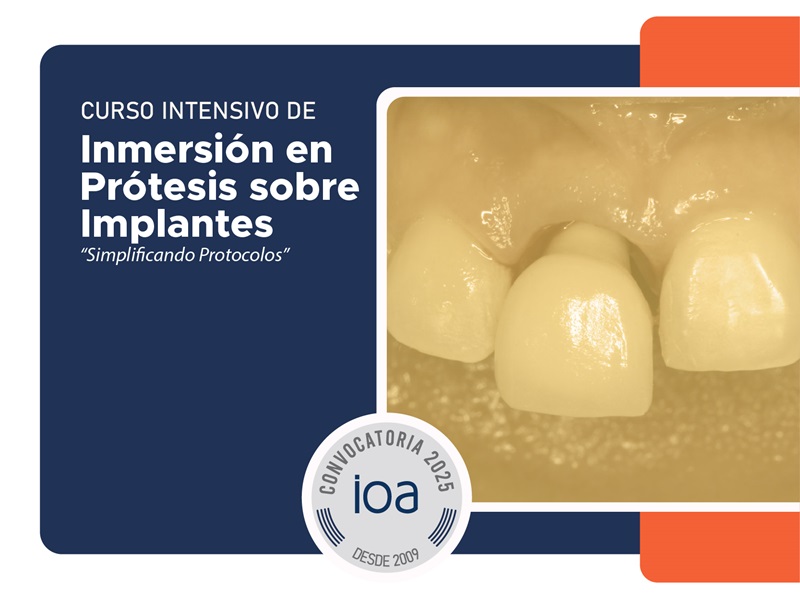 Curso Intensivo de Inmersión en Prótesis sobre Implantes
