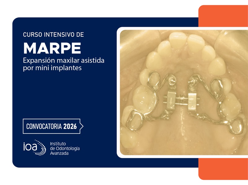 Curso Intensivo de MARPE – 2026