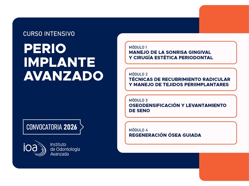 Curso Intensivo Perio Implante Avanzado – 2026