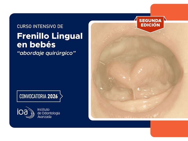 Curso Intensivo de Frenillo lingual en bebés «Abordaje quirúrgico» – 2026