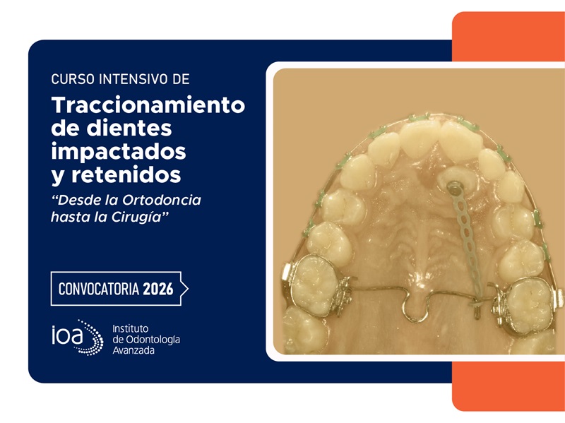 Curso Intensivo de Traccionamiento de dientes impactados y retenidos – 2026