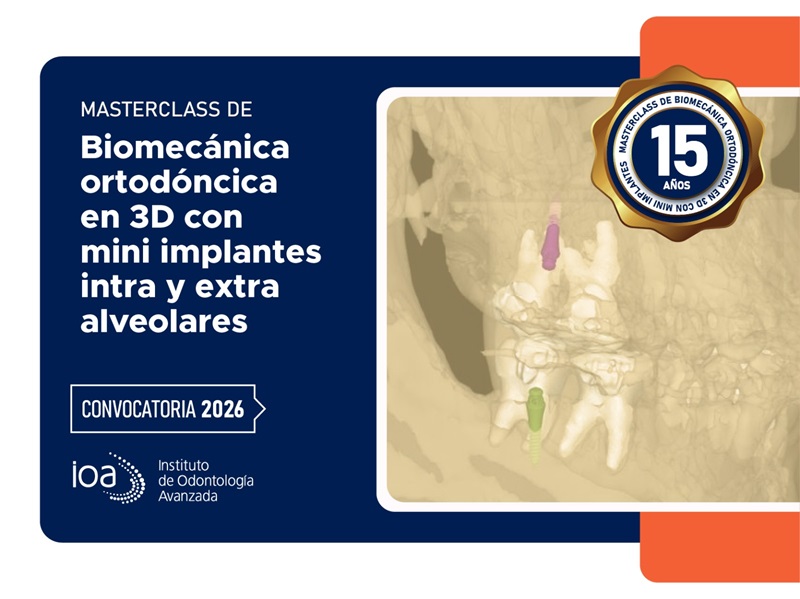Curso intensivo Mini implantes intra y extra alveolares