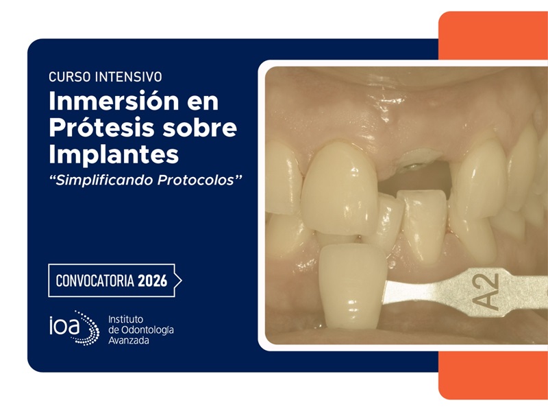 Curso Intensivo Inmersión en Prótesis sobre implantes
