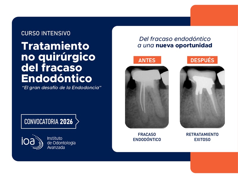 Curso Intensivo Tratamiento no quirúrgico del fracaso Endodóntico – 2026