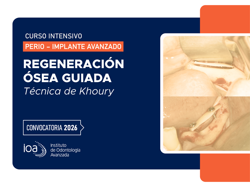 Curso Intensivo Regeneración Ósea guiada – 2026