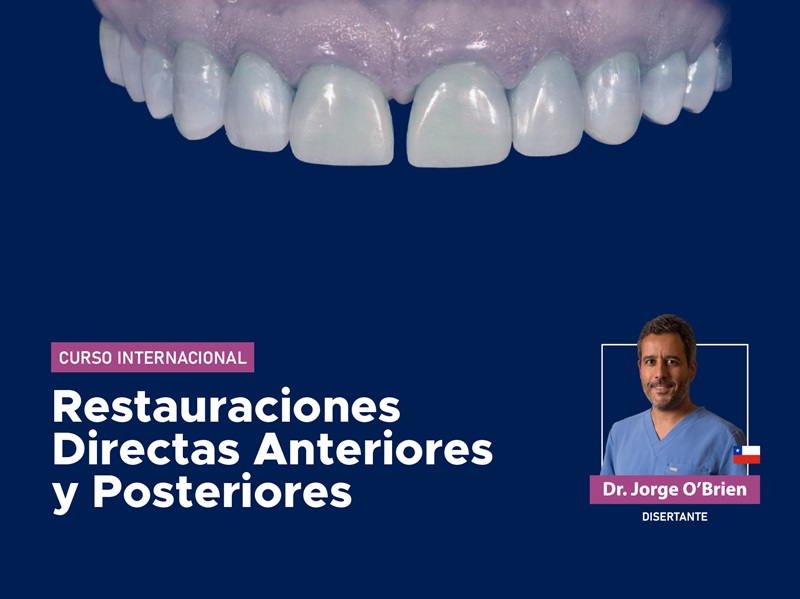 Curso Internacional Restauraciones Directas Anteriores y Posteriores – 2026