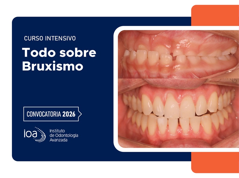 Curso Intensivo Todo sobre Bruxismo – 2026