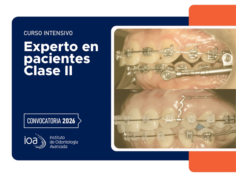 Curso Intensivo Experto en pacientes clase II – 2026