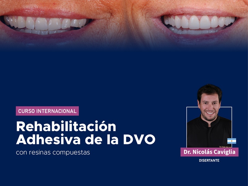 Curso Internacional Rehabilitación Adhesiva de la DVO – 2026